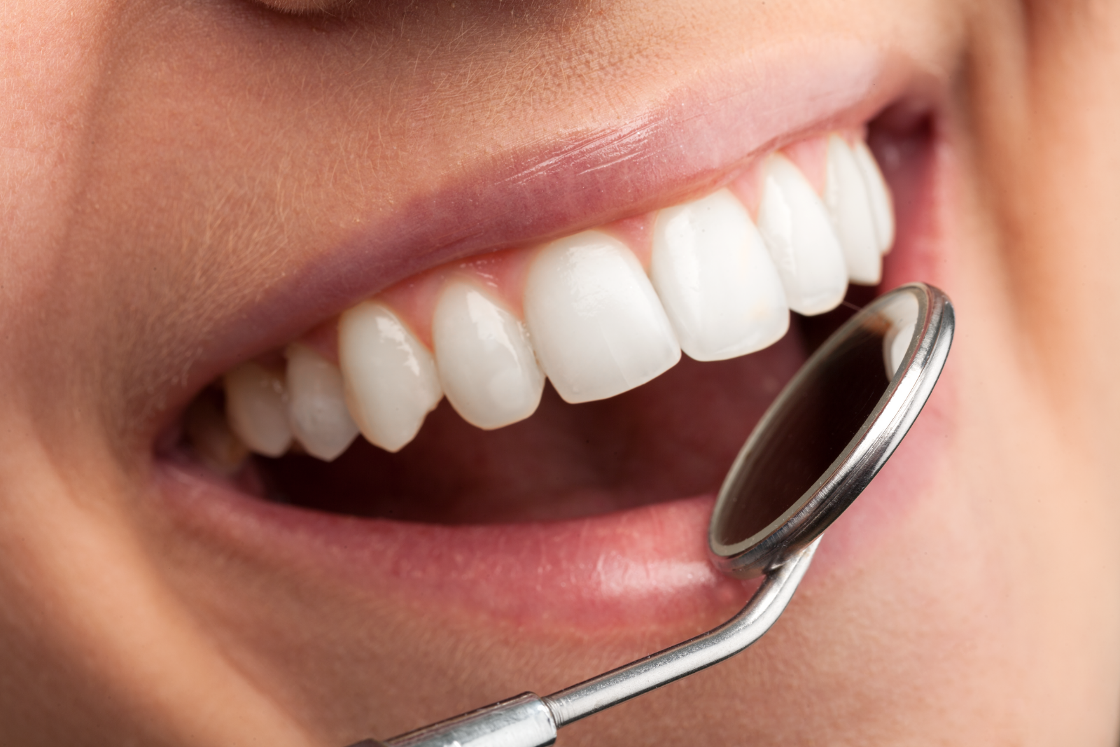 Procedura dentale eseguita dalla Dott.ssa Caporossi